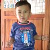 alditulle