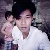 acu_tieunhi