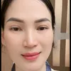 nguyenakira5