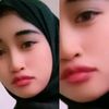 ssy1179