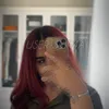 user_sur4