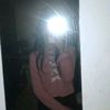 _milia44