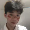 knanh11080111