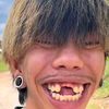 yohanesfishit