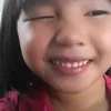 cmbnoc