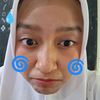 .anotherput