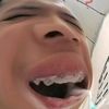 gnxkub