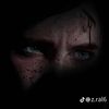 wsmialshmri