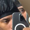 dumbahhlightskin