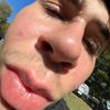 big_pineapple0
