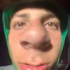 its_itch