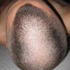 cpn101