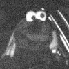 dasechtekruemmelmonster
