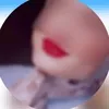 cxur_5
