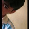 ale_xi26