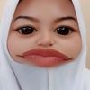 stnpdllaa