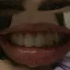 ng2ngph