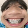 aloneplm