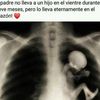 hugohernandez4805
