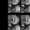 lynn_abil