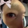 rann_gnasa0_0