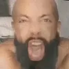bright_flamed