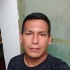 jamesextremoceles