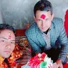 anilbudna4955