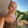 amys.alopecia