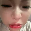 nth__192