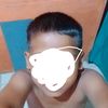 nacwt1