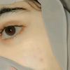 wkihunyr6