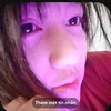 _thocutis1tg_