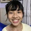 nalh2i_