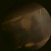 mimupp_02