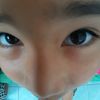 focus_chon