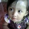alangadiss