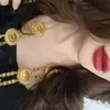 frecklesshh