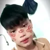 anhquyen1701