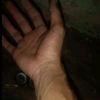 antosureng