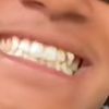 mopskissnaggletooth
