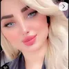 zxzx__mm