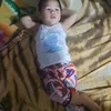 aldrinenopia1