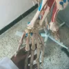 vo4kll