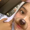 lvrma1