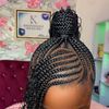 khaffiegold_hairline