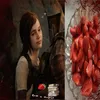 erynerein