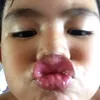 ynoe_bbal