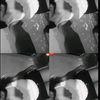 colmenareshemelyn325