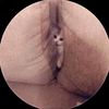 _sepele05